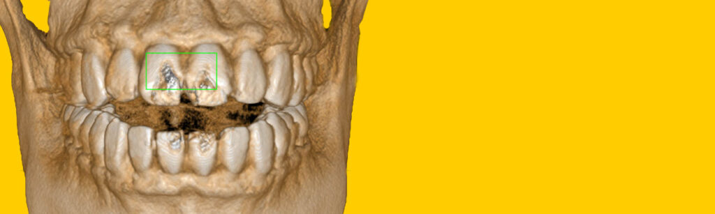 Uge 18: Opbevaring af CBCT - PTO spørger STPS